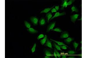 Image no. 1 for anti-Neural Wiskott-Aldrich syndrome protein (WASL) (AA 97-185) antibody (ABIN598590) (Neural Wiskott-Aldrich syndrome protein (WASL) (AA 97-185) Antikörper)