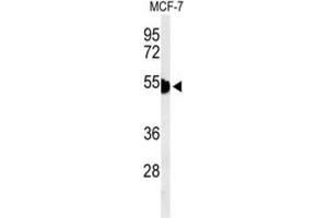 Western Blotting (WB) image for anti-Keratin 1 (KRT1) antibody (ABIN3004280) (Cytokeratin 1 Antikörper)