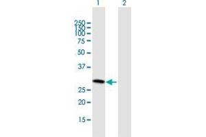 Western Blot analysis of SLC25A27 expression in transfected 293T cell line by SLC25A27 MaxPab polyclonal antibody. (SLC25A27 Antikörper  (AA 1-245))