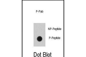 Dot blot analysis of anti-EGFR B1 Phospho-specific Pab (ABIN389891 and ABIN2839735) on nitrocellulose membrane. (EGFR Antikörper  (pTyr1016))