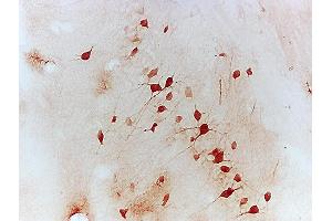 Immunohistochemistry (IHC) image for anti-Nuclear Factor of Activated T-Cells, Cytoplasmic, Calcineurin-Dependent 1 (NFATC1) (AA 601-716) antibody (ABIN686257)