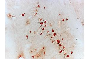 Mouse Hippocampal tissue labeled with Anti-NFATc1/NFAT2 Polyclonal Antibody, Unconjugated (ABIN686257) followed by conjugation to the secondary antibody (NFATC1 Antikörper  (AA 601-716))