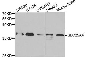 Western Blotting (WB) image for anti-Solute Carrier Family 25 (Mitochondrial Carrier, Adenine Nucleotide Translocator), Member 4 (SLC25A4) antibody (ABIN1874820) (SLC25A4 Antikörper)