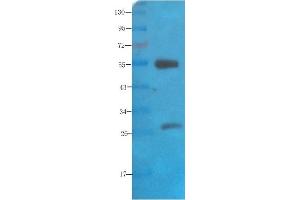 Western Blot using anti-polysialic acid antibody   Rat brain lysate was resolved on a 10% SDS PAGE gel and blots probed with  at 2 µg/ml before being detected by a secondary antibody. (Rekombinanter Polysialic Acid Antikörper)