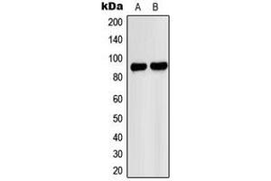 Western blot analysis of PNPLA8 expression in A549 (A), HeLa (B) whole cell lysates. (PNPLA8 Antikörper  (C-Term))