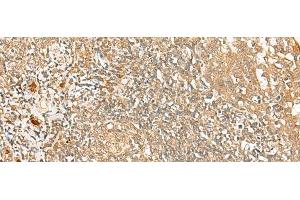 Immunohistochemistry of paraffin-embedded Human tonsil tissue using PROKR1 Polyclonal Antibody at dilution of 1:40(x200) (Prokineticin Receptor 1 Antikörper)