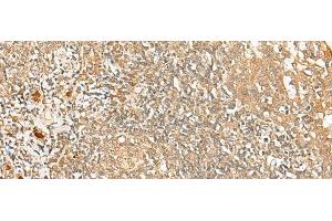 Immunohistochemistry of paraffin-embedded Human tonsil tissue using PROKR1 Polyclonal Antibody at dilution of 1:40(x200)