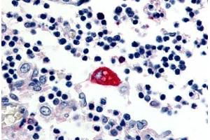 Immunohistochemistry (Paraffin-embedded Sections) (IHC (p)) image for anti-Egf-Like Module Containing, Mucin-Like, Hormone Receptor-Like 3 (EMR3) (C-Term) antibody (ABIN213514)