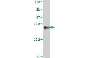 Western Blot detection against Immunogen (38. (TGIF1 Antikörper  (AA 163-272))