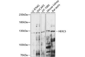 Western blot analysis of extracts of various cell lines, using HERC5 antibody (ABIN7267596) at 1:1000 dilution. (HERC5 Antikörper  (AA 360-700))