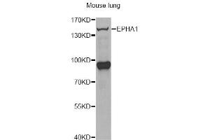 Western blot analysis of extracts of mouse lung, using EPHA1 antibody (ABIN6290349) at 1:1000 dilution. (EPHA1 Antikörper)