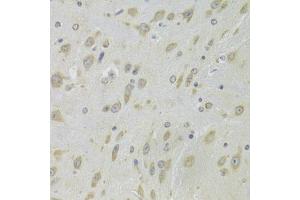 Immunohistochemistry of paraffin-embedded mouse brain using DHRS9 Antibody (ABIN5973740) at dilution of 1/100 (40x lens). (DHRS9 Antikörper)