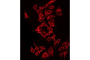 ABIN6275590 staining MCF7 by IF/ICC. (SLC24A6 Antikörper  (C-Term))