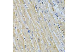 Immunohistochemistry of paraffin-embedded rat heart using NME1 Antibody. (NME1 Antikörper  (C-Term))