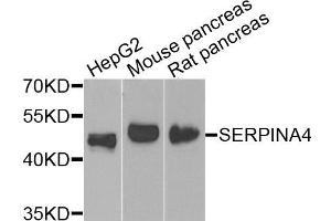 Western blot analysis of extracts of various cells, using SERPINA4 antibody. (SERPINA4 Antikörper)
