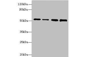 Western blot All lanes: STK38L antibody at 6 μg/mL Lane 1: A375 whole cell lysate Lane 2: HepG2 whole cell lysate Lane 3: A549 whole cell lysate Lane 4: HCT116 whole cell lysate Secondary Goat polyclonal to rabbit IgG at 1/10000 dilution Predicted band size: 55, 44 kDa Observed band size: 55 kDa (STK38L Antikörper  (AA 212-464))