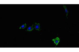 Immunofluorescent analysis of Hela cells using ABIN7176901 at dilution of 1:100 and Alexa Fluor 488-congugated AffiniPure Goat Anti-Rabbit IgG(H+L) (LYPLA1 Antikörper  (AA 1-230))