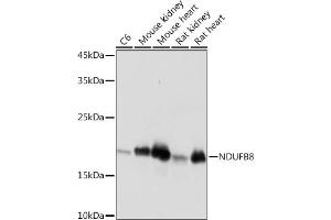Western blot analysis of extracts of various cell lines, using NDUFB8 Rabbit mAb (ABIN7268813) at 1:1000 dilution. (NDUFB8 Antikörper)