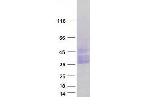 Western Blotting (WB) image for Osteoclast Associated Receptor (OSCAR) (Transcript Variant 3) protein (Myc-DYKDDDDK Tag) (ABIN2727999)