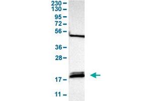 Western Blot analysis of human cell line RT-4 with PTRH2 polyclonal antibody . (PTRH2 Antikörper  (AA 42-178))