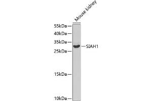 Western Blotting (WB) image for anti-E3 Ubiquitin-Protein Ligase SIAH1 (SIAH1) (AA 1-313) antibody (ABIN3016132)