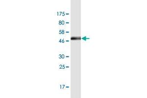 Western Blot detection against Immunogen (48. (RAB13 Antikörper  (AA 1-203))