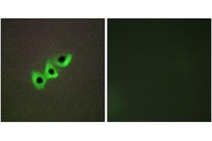 Immunofluorescence analysis of A549 cells, using RHG07 Antibody. (DLC1 Antikörper  (AA 61-110))