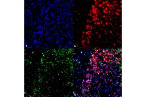 Immunocytochemistry/Immunofluorescence analysis using Mouse Anti-Alpha Synuclein Monoclonal Antibody, Clone 3F8 (ABIN5564099). (SNCA Antikörper  (APC))
