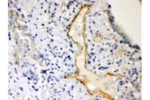 Immunohistochemistry (IHC) image for anti-Purinergic Receptor P2X, Ligand Gated Ion Channel 2 (P2RX2) (AA 139-471) antibody (ABIN3043588)