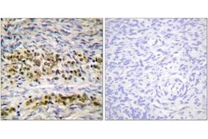 Immunohistochemistry analysis of paraffin-embedded human ovary tissue, using NF-kappaB p105/p50 (Ab-923) Antibody. (NFKB1 Antikörper  (AA 891-940))