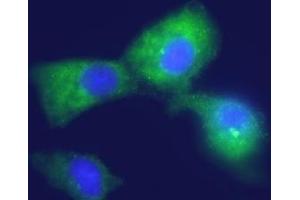 Expression of Kir4. (KCNJ10 Antikörper  (Intracellular))