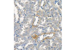 Immunohistochemistry of paraffin embedded rat kidney using Cdcp1 (ABIN7073600) at dilution of 1:300 (400x lens)