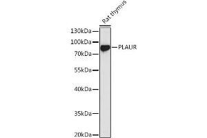 Western blot analysis of extracts of Rat thymus, using PLAUR antibody (ABIN3015469, ABIN3015470, ABIN5663892 and ABIN6218162) at 1:1000 dilution. (PLAUR Antikörper  (AA 23-305))