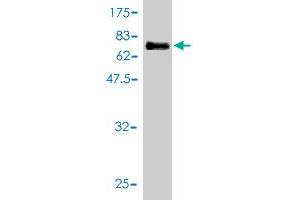 Western Blot detection against Immunogen (63. (NCAPD3 Antikörper  (AA 1-341))