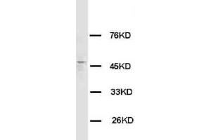 Anti-HRH3 antibody, Western blotting WB: Rat Brain Tissue Lysate (HRH3 Antikörper  (C-Term))