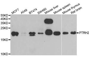 Western blot analysis of extracts of various cell lines, using PTRH2 antibody (ABIN5973864) at 1/1000 dilution.
