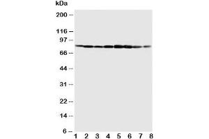 Western blot testing of MCM7 antibody and Lane 1:  COLO320;  2: SW620;  3: HeLa;  4: 22RVL;  5: 293T;  6: U937;  7: Jurkat;  8: Raji cell lysate. (MCM7 Antikörper  (C-Term))