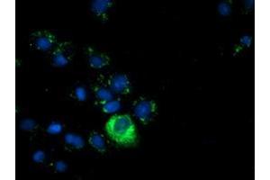 Anti-AFP mouse monoclonal antibody (ABIN2452712) immunofluorescent staining of COS7 cells transiently transfected by pCMV6-ENTRY AFP (RC206622). (alpha Fetoprotein Antikörper)