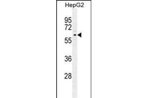 ARD Antibody (C-term) (ABIN655880 and ABIN2845281) western blot analysis in HepG2 cell line lysates (35 μg/lane). (PPARD Antikörper  (C-Term))