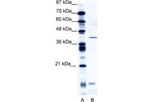 Western Blotting (WB) image for anti-CAMP Responsive Element Modulator (CREM) antibody (ABIN2461049) (CREM Antikörper)