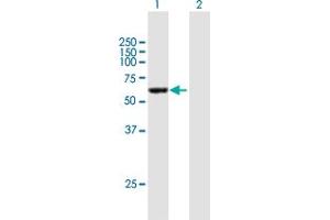 Western Blot analysis of CCDC6 expression in transfected 293T cell line by CCDC6 MaxPab polyclonal antibody. (CCDC6 Antikörper  (AA 1-474))
