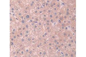 Used in DAB staining on fromalin fixed paraffin- embedded Kidney tissue (ABCB11 Antikörper  (AA 421-663))