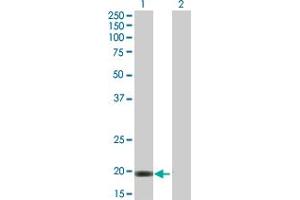 Western Blot analysis of VSTM2L expression in transfected 293T cell line by VSTM2L MaxPab polyclonal antibody. (VSTM2L Antikörper  (AA 1-204))