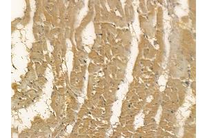 DCXR Mouse Monoclonal Antibody at 1/100 staining rat heart tissue by IHC-P. (DCXR Antikörper)