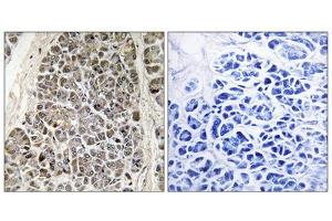 Immunohistochemistry analysis of paraffin-embedded human pancreas tissue using MRPS21 antibody. (MRPS21 Antikörper  (Internal Region))