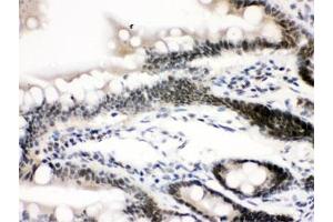 IHC testing of FFPE rat intestine with CTCF antibody. (CTCF Antikörper  (AA 521-727))