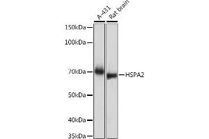 Western blot analysis of extracts of various cell lines, using HSP Rabbit mAb (ABIN7267579) at 1:1000 dilution. (HSPA2 Antikörper)