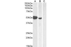 ABIN184677 (1µg/ml) staining of Human Muscle (A), (2ug/ml) MOLT4 (B) and (1µg/ml) negative control Pancreas (C) lysate (35µg protein in RIPA buffer). (FOXP3 Antikörper  (C-Term))