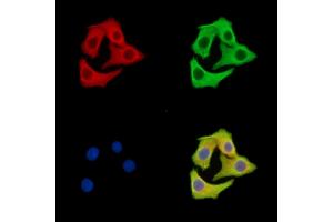 ABIN7095985 and ABIN7100047 staining Hela cells by IF/ICC. (GOLGA6B Antikörper)