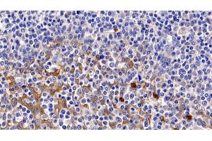 Immunohistochemistry (IHC) image for anti-Caspase 3 (CASP3) (AA 29-175) antibody (ABIN7428803)